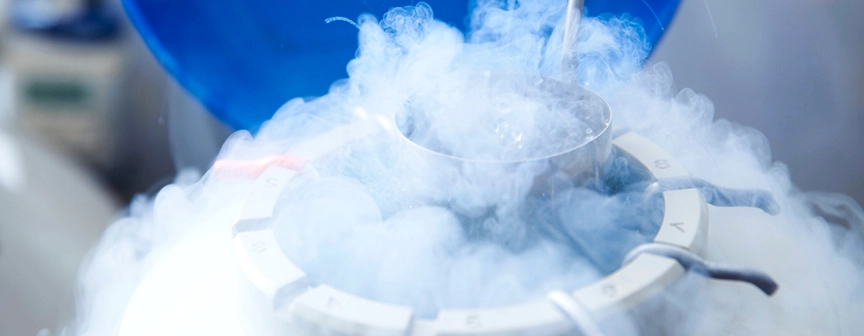 cryogenic industry